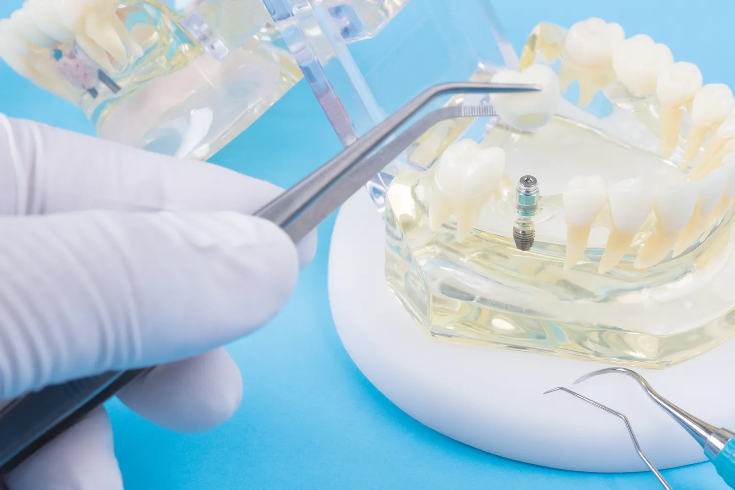 Endodoncja ranking Szczecin